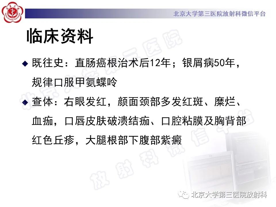 影像PPT - 【PPT】侵袭性肺曲霉菌病-3