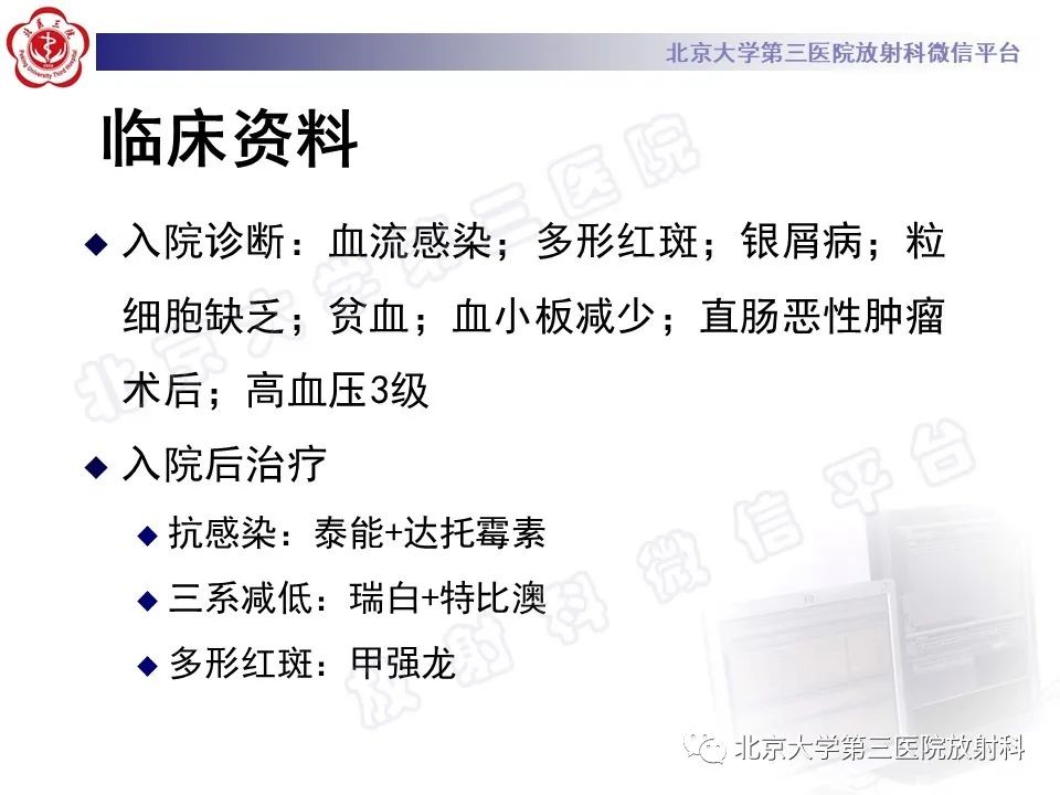 影像PPT - 【PPT】侵袭性肺曲霉菌病-5