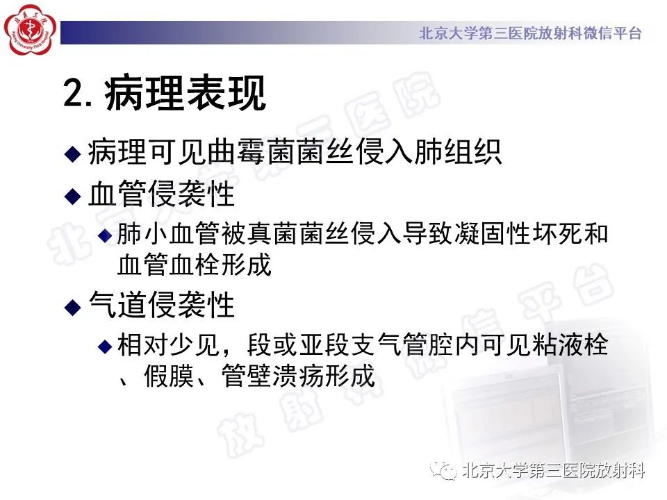 影像PPT - 【PPT】侵袭性肺曲霉菌病-20