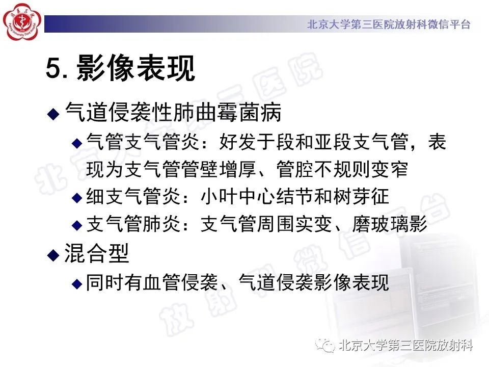 影像PPT - 【PPT】侵袭性肺曲霉菌病-30