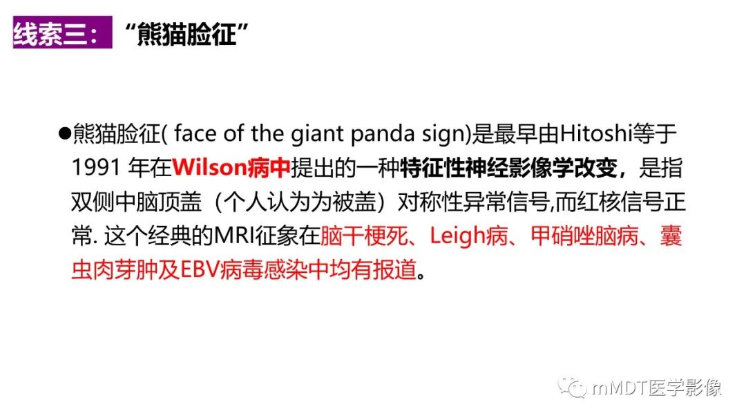 影像PPT - 【PPT】肝豆—熊猫征分析及综述-36 影像PPT - 【PPT】肝豆—熊猫征分析及综述-36