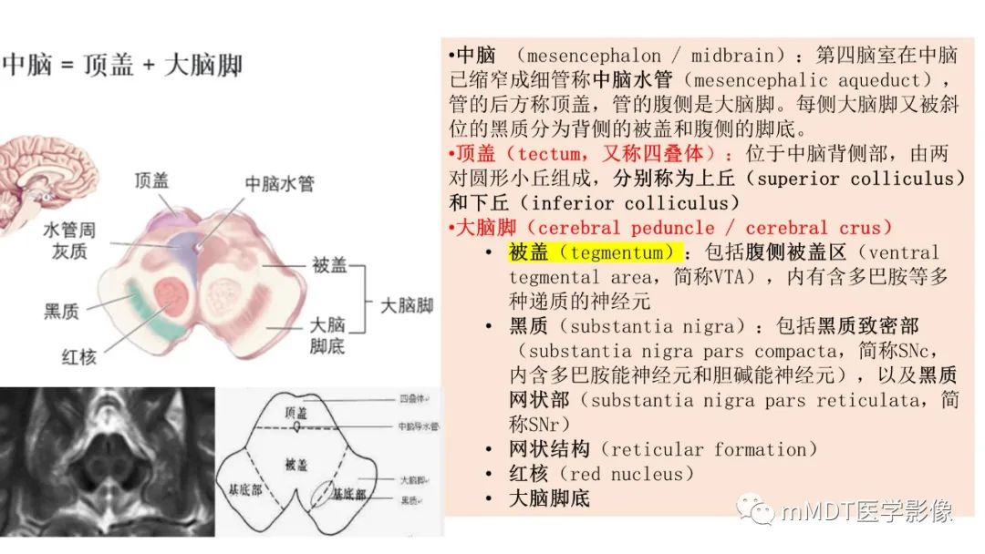 影像PPT - 【PPT】肝豆—熊猫征分析及综述-37 影像PPT - 【PPT】肝豆—熊猫征分析及综述-37