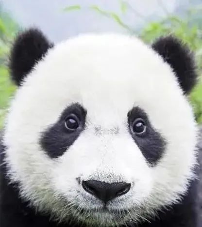 影像PPT - 【PPT】肝豆—熊猫征分析及综述-40 影像PPT - 【PPT】肝豆—熊猫征分析及综述-40