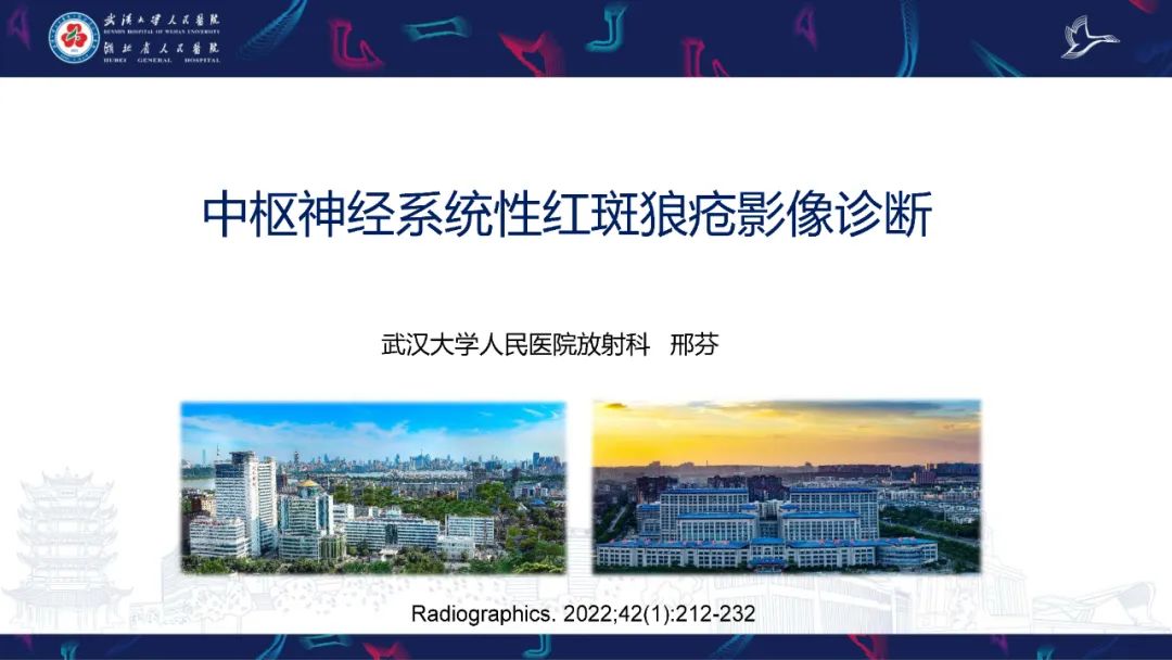 影像PPT - 【PPT】中枢神经系统性红斑狼疮影像诊断-1