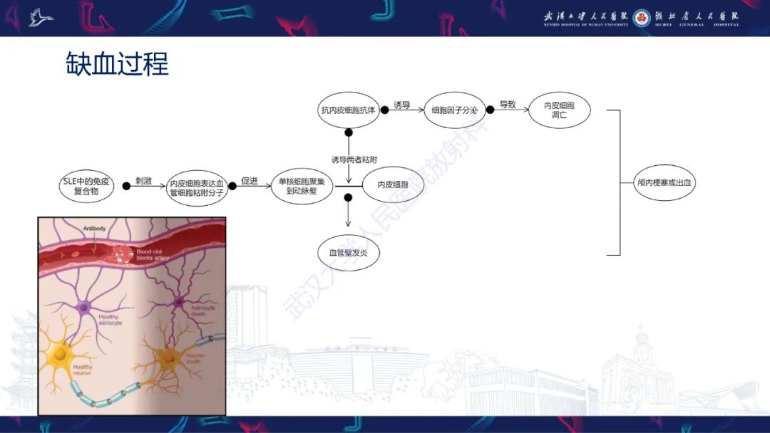 影像PPT - 【PPT】中枢神经系统性红斑狼疮影像诊断-4