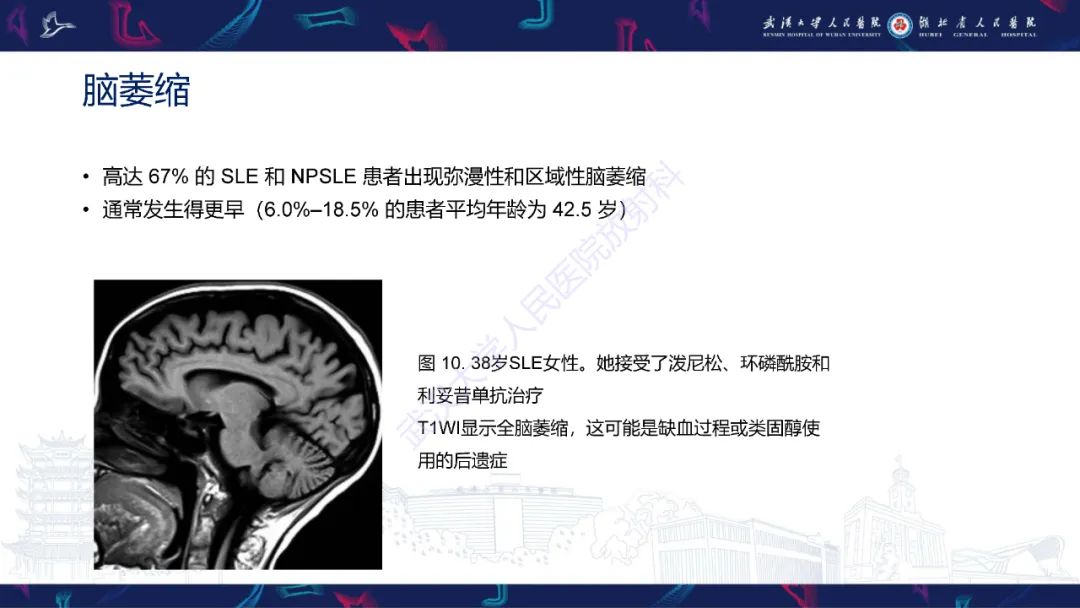 影像PPT - 【PPT】中枢神经系统性红斑狼疮影像诊断-17