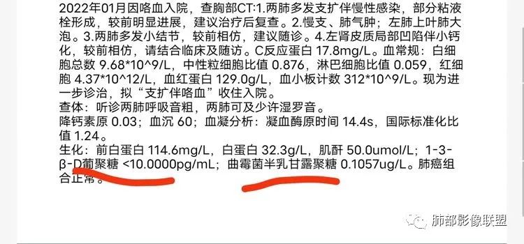 影像PPT - 【病例】 结核与非结核分枝杆菌感染-21 影像PPT - 【病例】 结核与非结核分枝杆菌感染-21