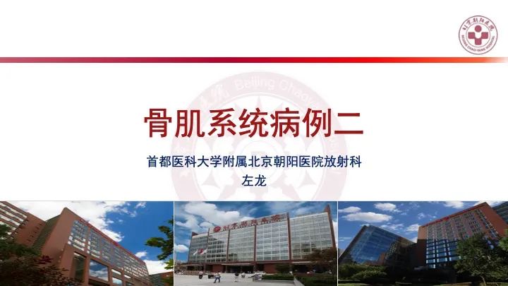 影像PPT - 【PPT】股骨坐骨撞击综合征（IFIS）-9
