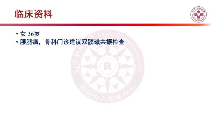 影像PPT - 【PPT】股骨坐骨撞击综合征（IFIS）-10