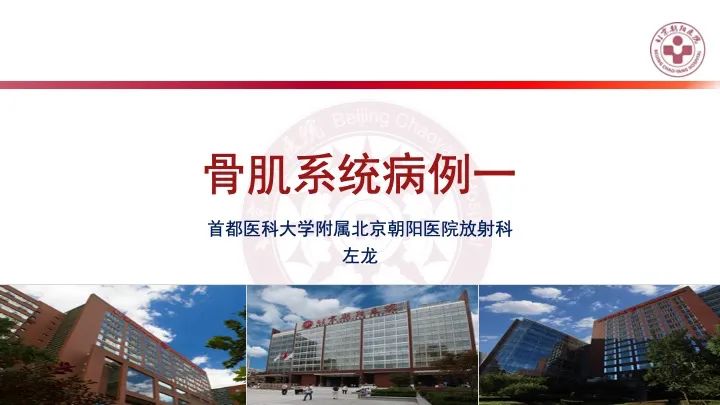 影像PPT - 【PPT】股骨坐骨撞击综合征（IFIS）-1