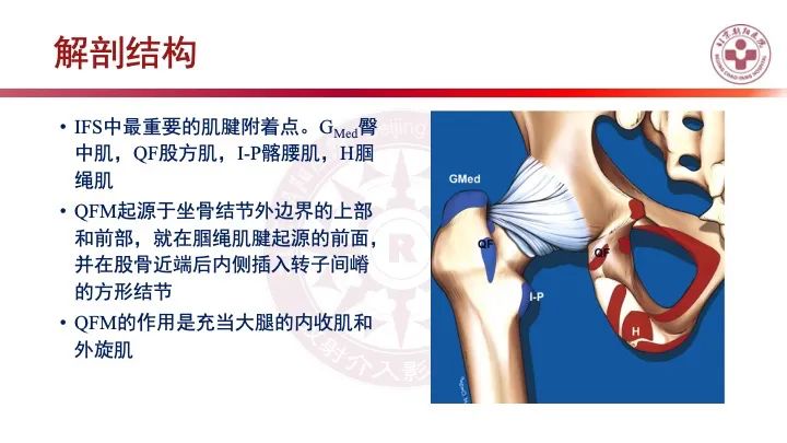 影像PPT - 【PPT】股骨坐骨撞击综合征（IFIS）-17