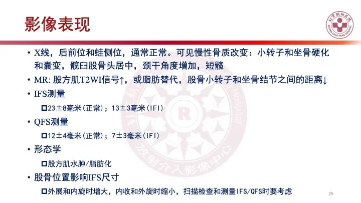 影像PPT - 【PPT】股骨坐骨撞击综合征（IFIS）-24