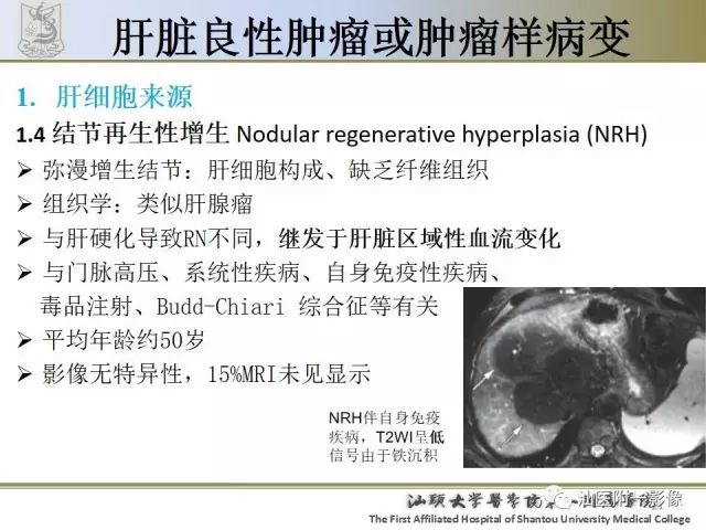 影像PPT - 【PPT】肝脏良性肿瘤或肿瘤样病变-19