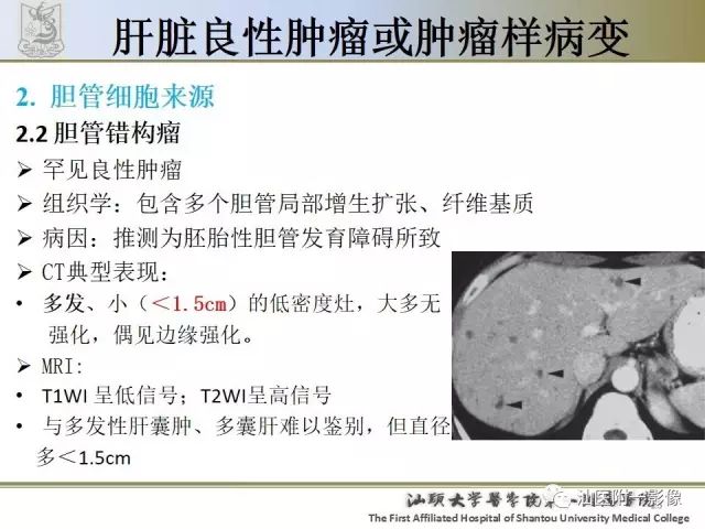 影像PPT - 【PPT】肝脏良性肿瘤或肿瘤样病变-21