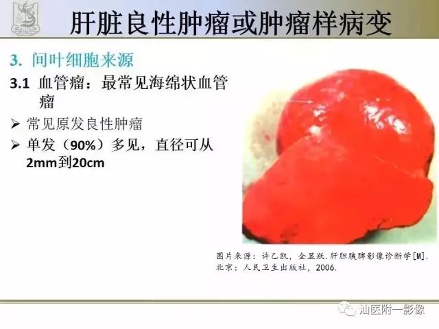 影像PPT - 【PPT】肝脏良性肿瘤或肿瘤样病变-28