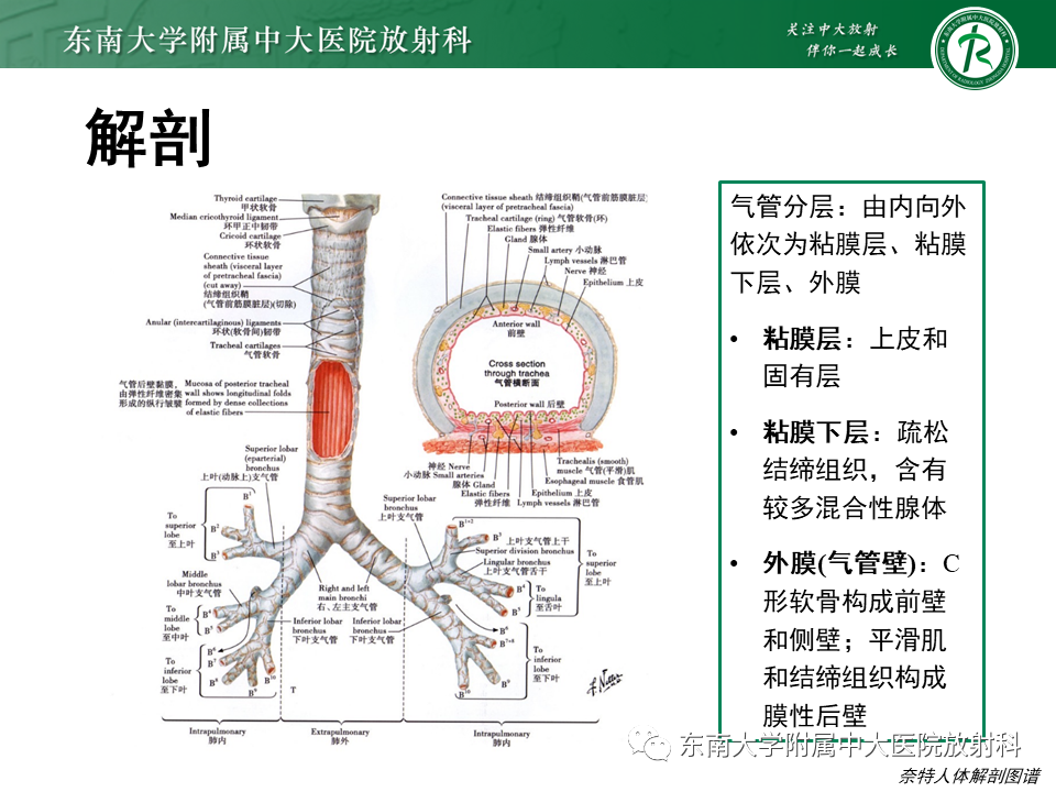 影像PPT - 【PPT】气管腺样囊性癌-9