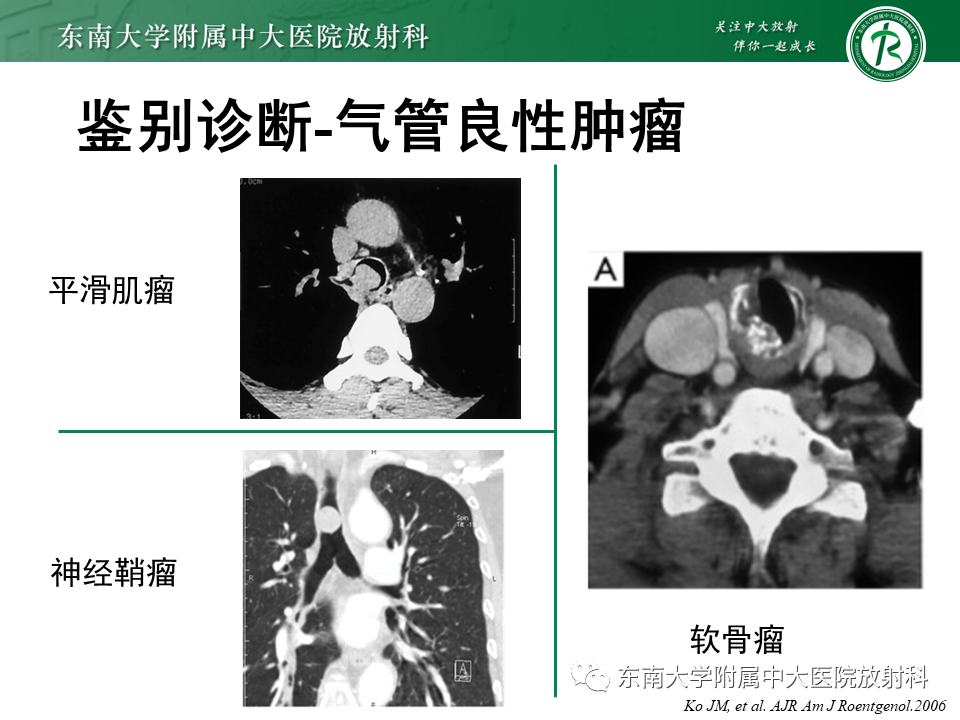 影像PPT - 【PPT】气管腺样囊性癌-22