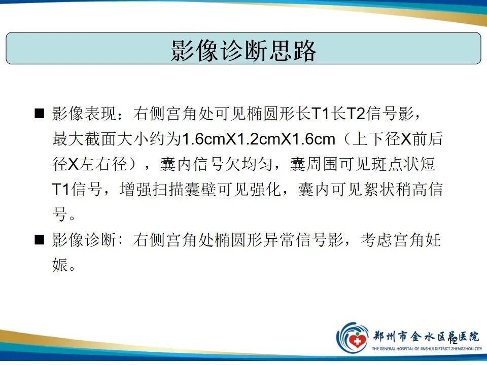 影像PPT - 【PPT】异位妊娠影像学诊断-12