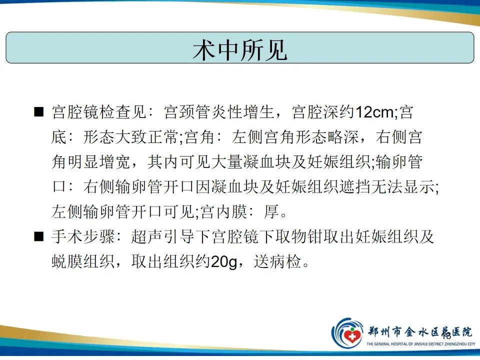 影像PPT - 【PPT】异位妊娠影像学诊断-13
