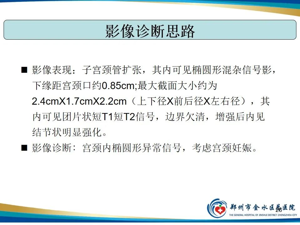 影像PPT - 【PPT】异位妊娠影像学诊断-26