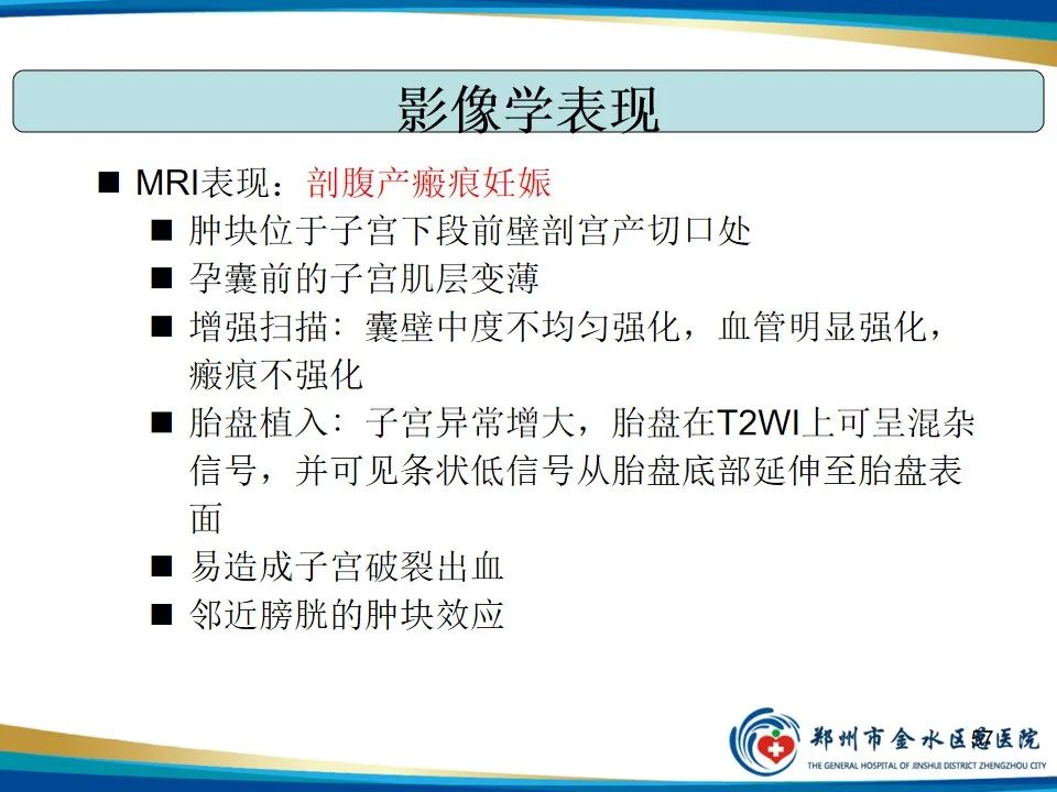 影像PPT - 【PPT】异位妊娠影像学诊断-57