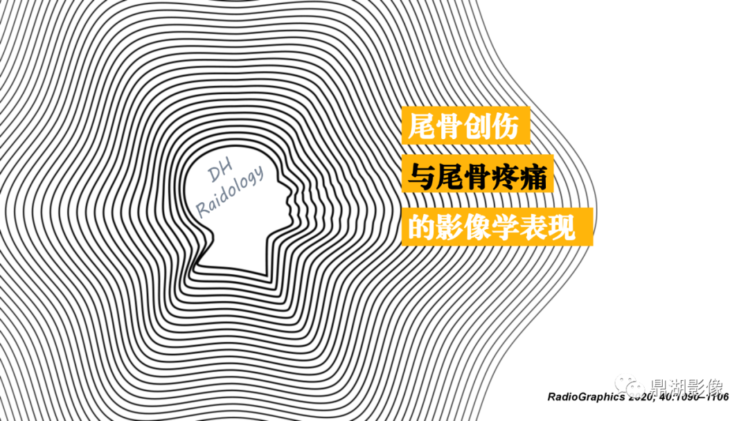 影像PPT - 【PPT】尾骨创伤与尾骨疼痛的影像学表现-1