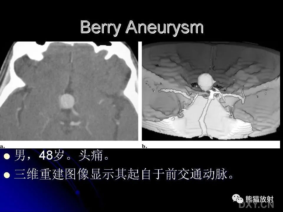 影像PPT - 【PPT】和食物有关的影像学征象-15
