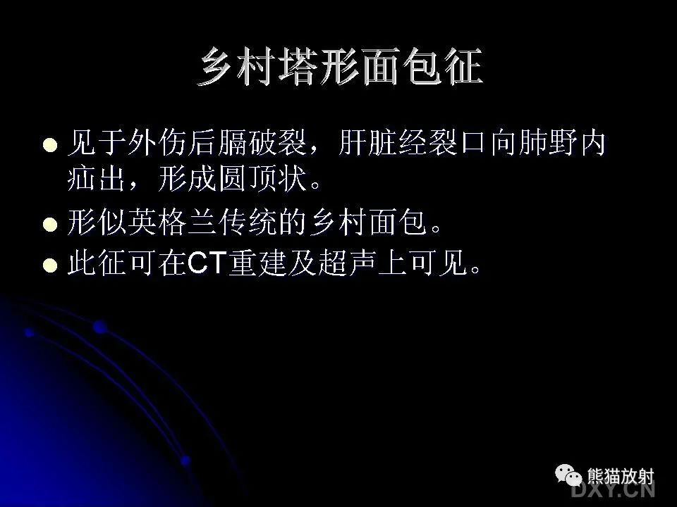 影像PPT - 【PPT】和食物有关的影像学征象-30