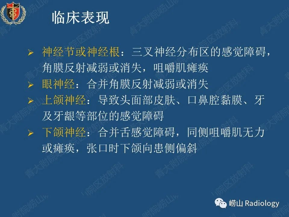 影像PPT - 【病例】三叉神经神经鞘瘤1例CT及MR影像-27