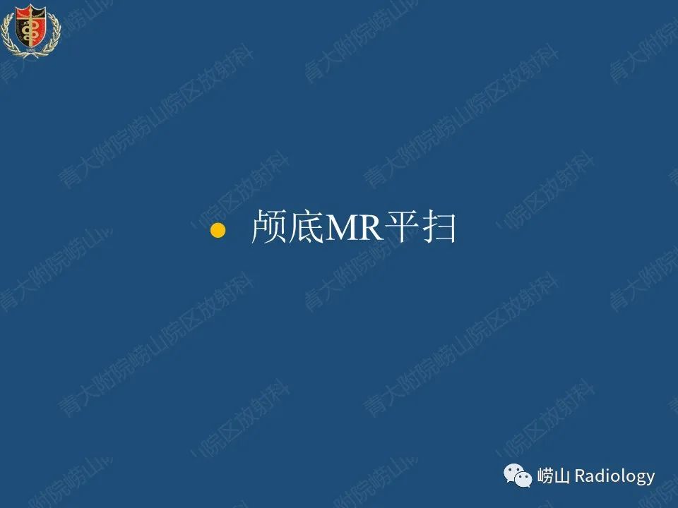 影像PPT - 【病例】三叉神经神经鞘瘤1例CT及MR影像-11