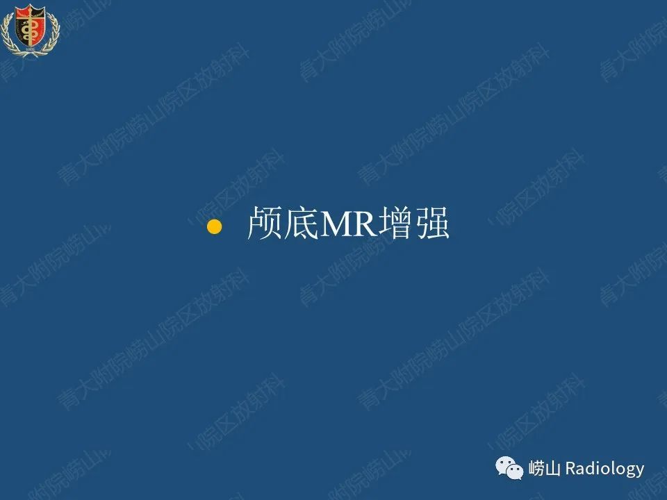 影像PPT - 【病例】三叉神经神经鞘瘤1例CT及MR影像-17