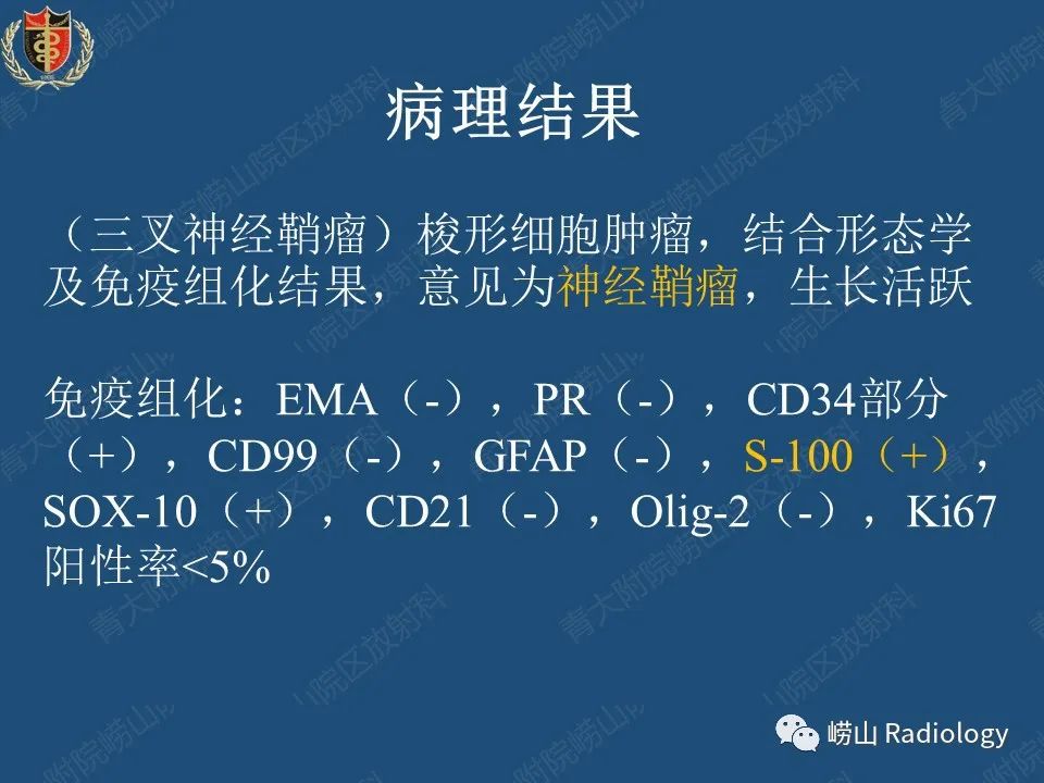 影像PPT - 【病例】三叉神经神经鞘瘤1例CT及MR影像-22