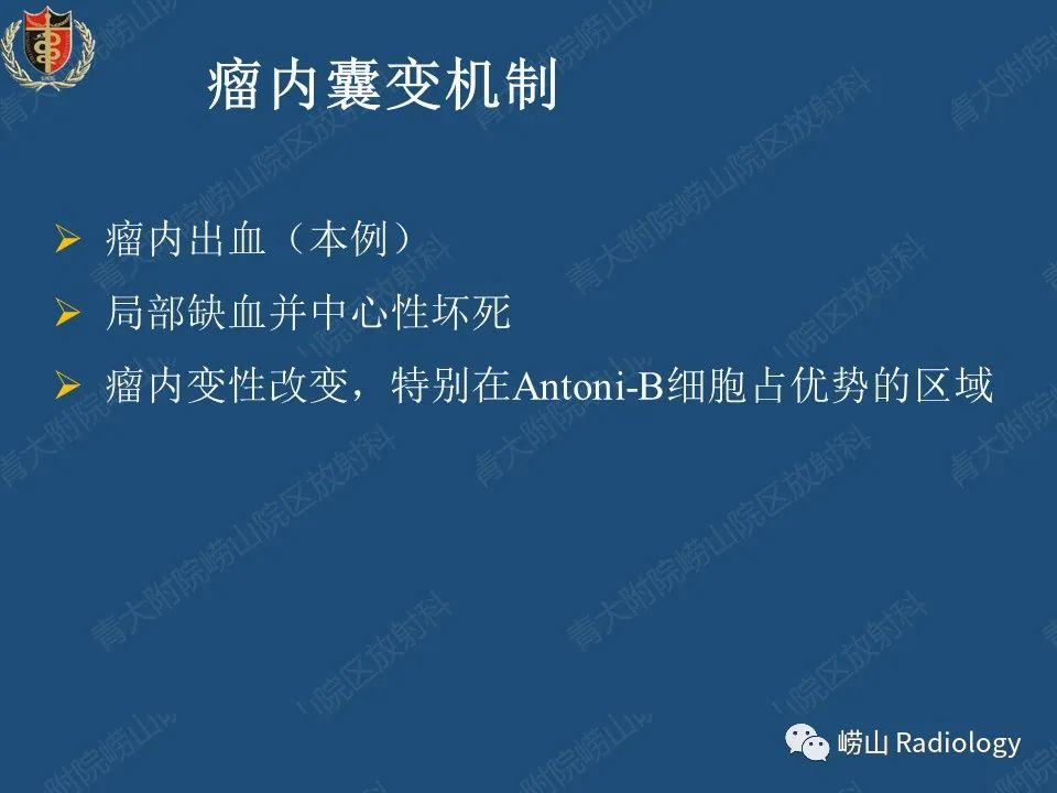 影像PPT - 【病例】三叉神经神经鞘瘤1例CT及MR影像-30