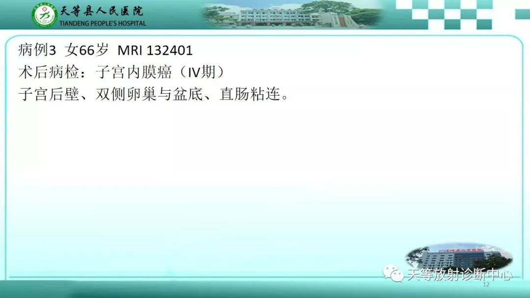 影像PPT - 【PPT】子宫内膜癌MRI诊断要点与鉴别诊断-12
