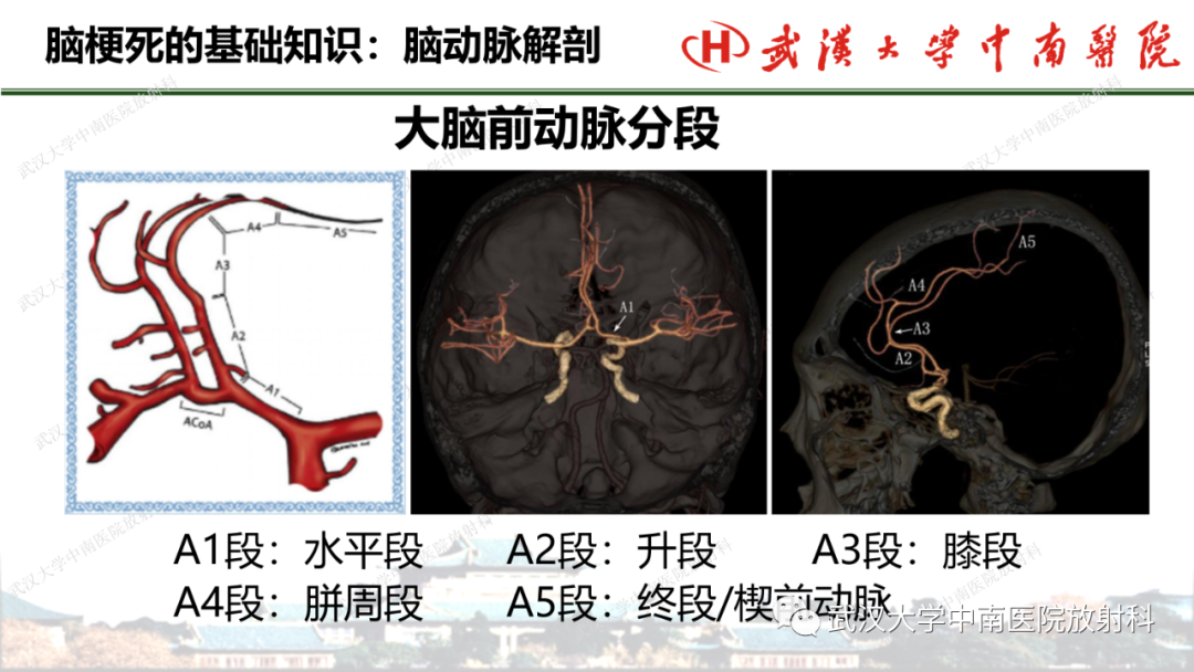 影像PPT - 【PPT】脑梗死的影像学表现-9
