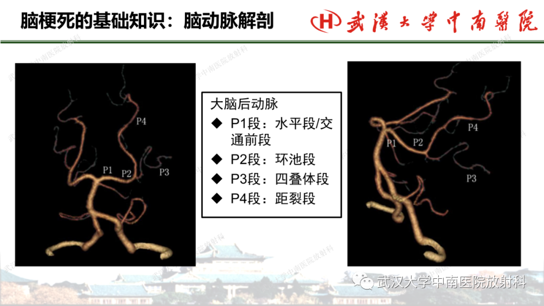 影像PPT - 【PPT】脑梗死的影像学表现-16
