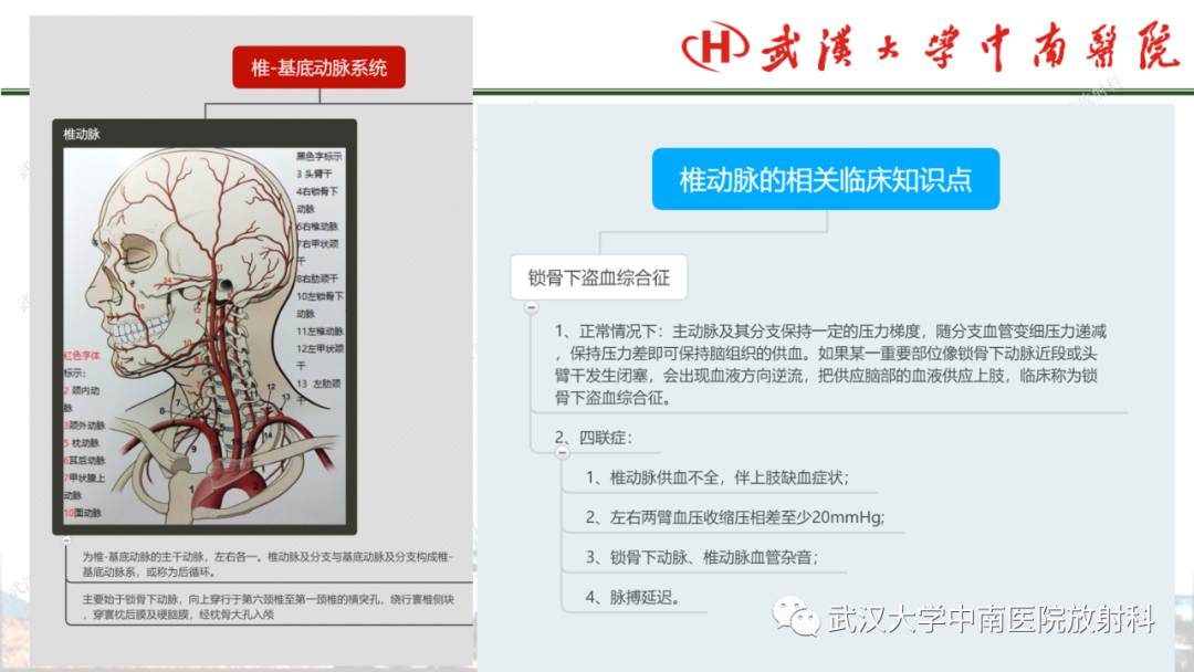 影像PPT - 【PPT】脑梗死的影像学表现-11