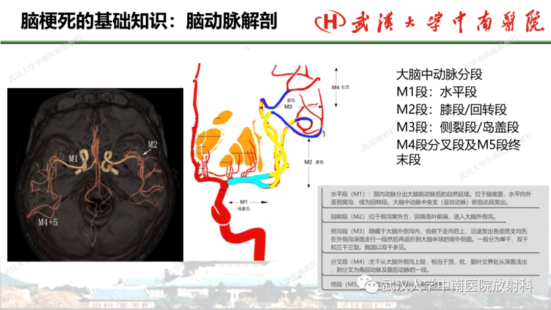 影像PPT - 【PPT】脑梗死的影像学表现-10