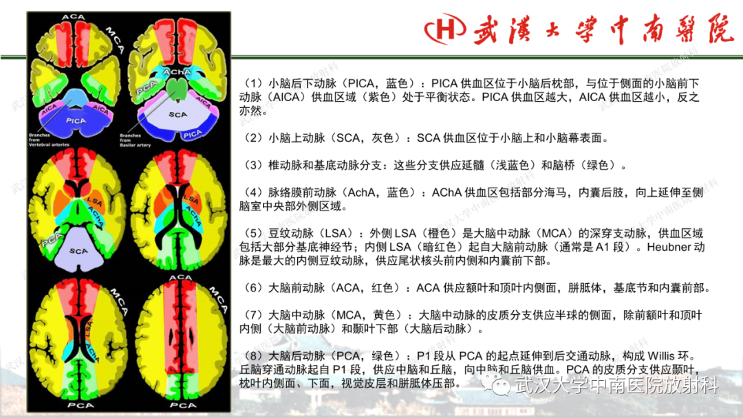 影像PPT - 【PPT】脑梗死的影像学表现-19