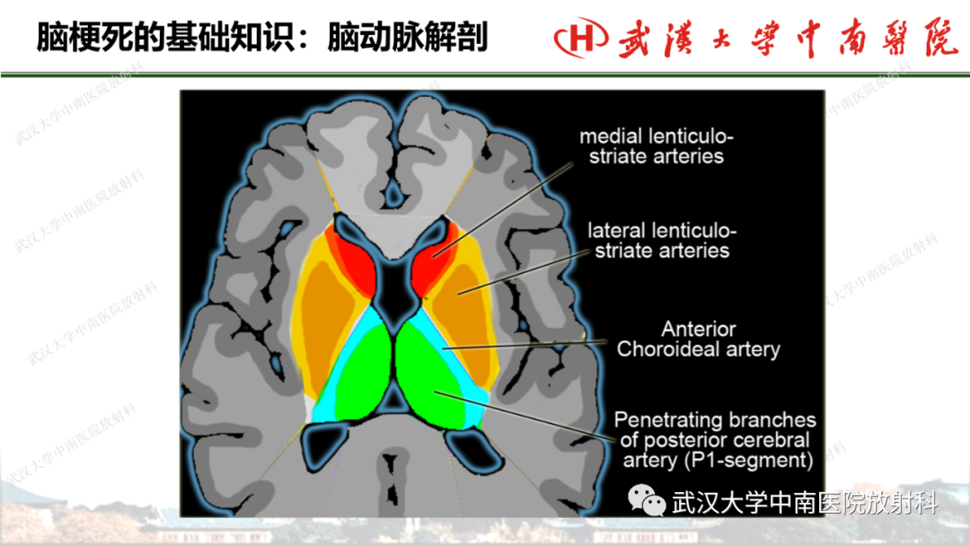 影像PPT - 【PPT】脑梗死的影像学表现-20
