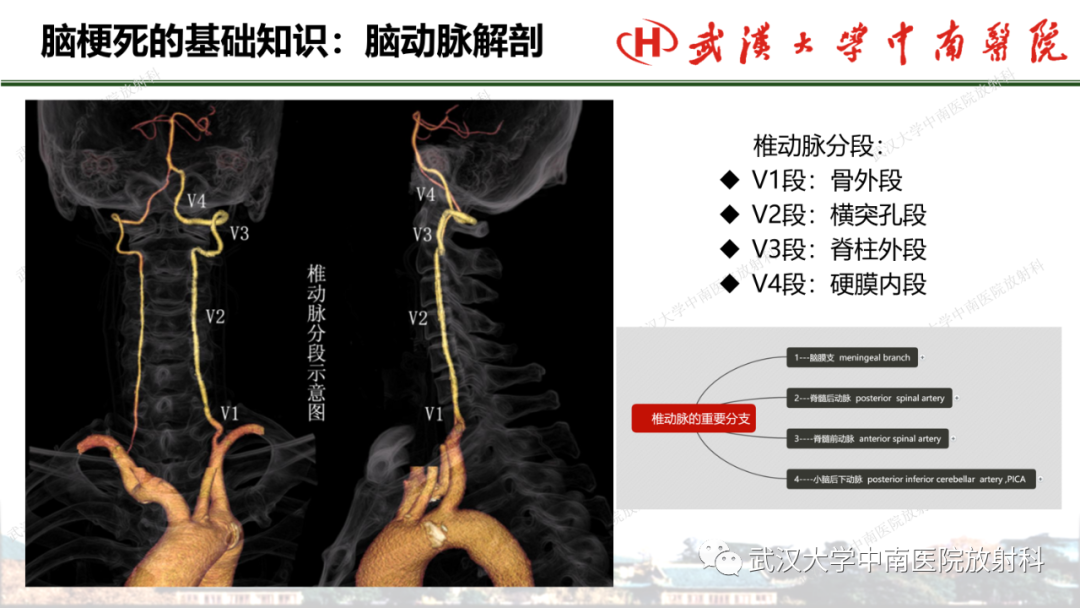影像PPT - 【PPT】脑梗死的影像学表现-12