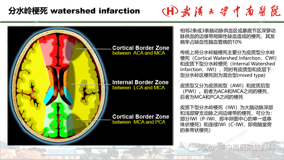 影像PPT - 【PPT】脑梗死的影像学表现-39