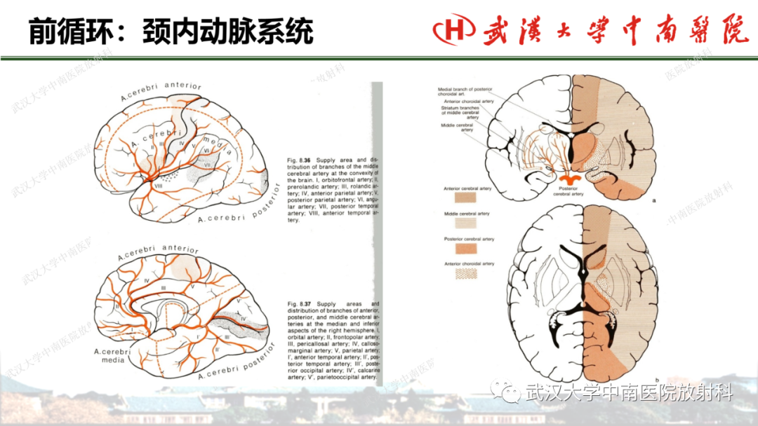 影像PPT - 【PPT】脑梗死的影像学表现-17