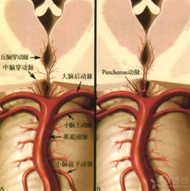 影像PPT - 累及双侧丘脑的 15 种疾病,除了脑梗死,你还见过哪几个?-3 影像PPT - 累及双侧丘脑的 15 种疾病,除了脑梗死,你还见过哪几个?-3