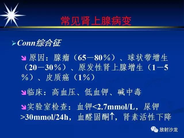 影像PPT - 【PPT】肾上腺影像学诊断-15