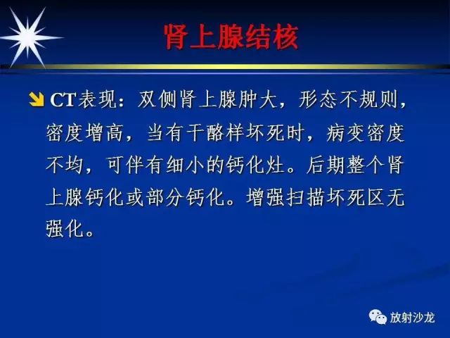 影像PPT - 【PPT】肾上腺影像学诊断-50