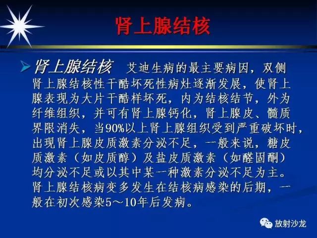 影像PPT - 【PPT】肾上腺影像学诊断-49
