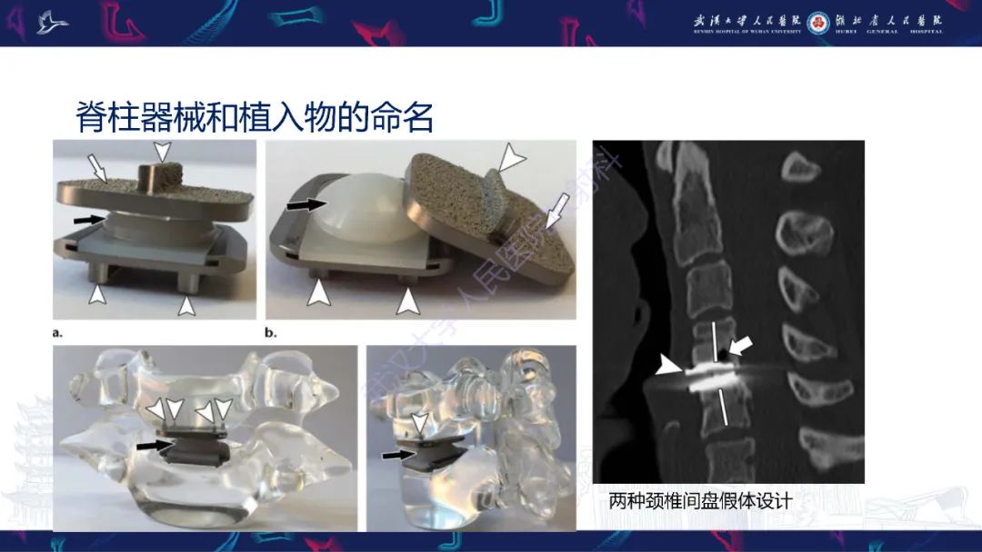 影像PPT - 【PPT】脊柱术后CT评估-17