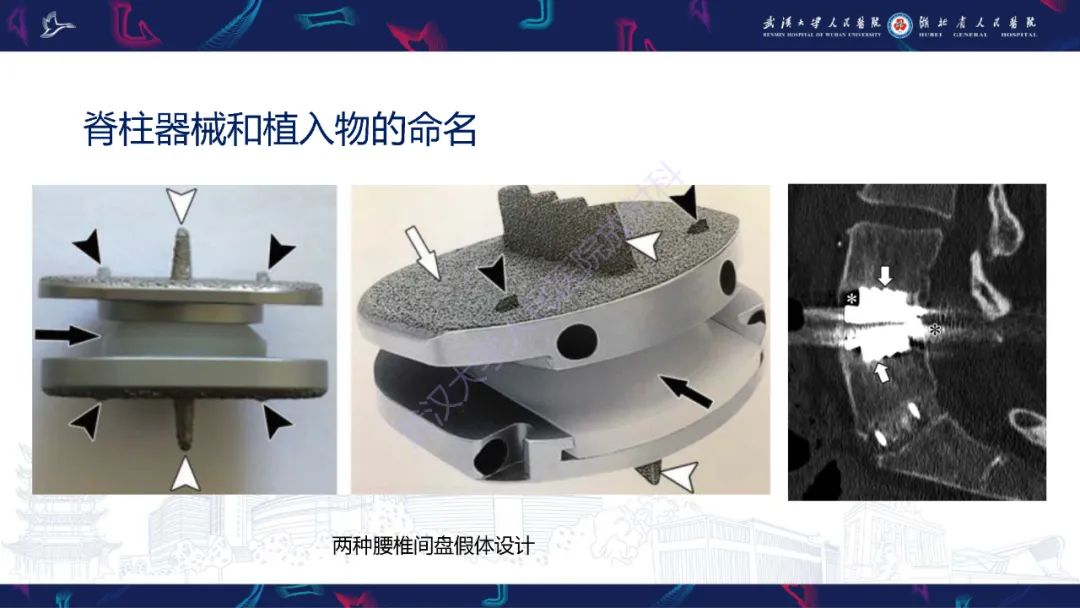 影像PPT - 【PPT】脊柱术后CT评估-18