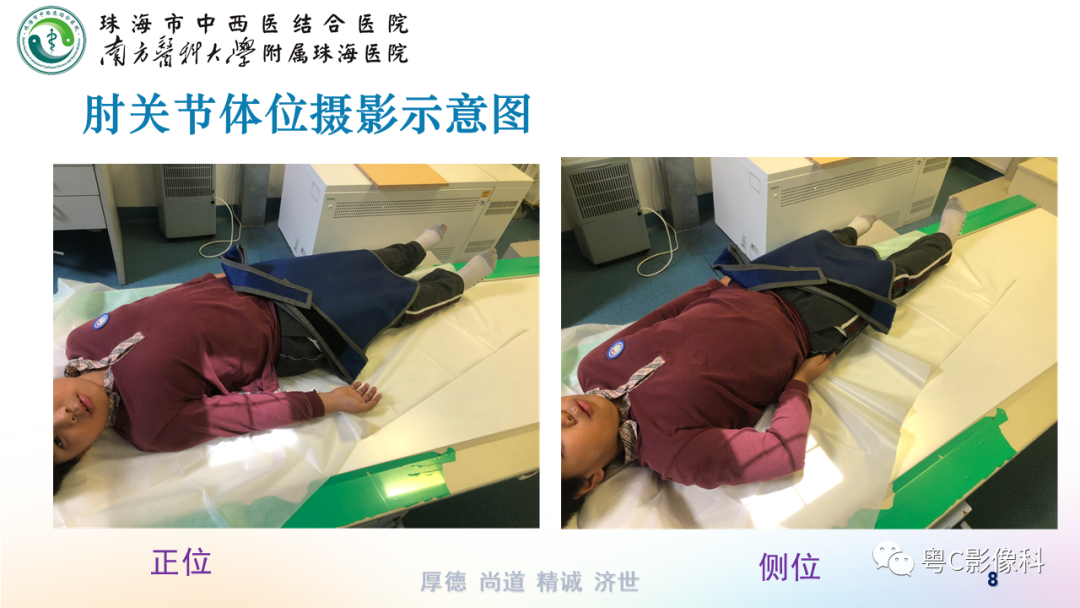 影像PPT - 【PPT】儿童肘关节正侧位x线摄影-8